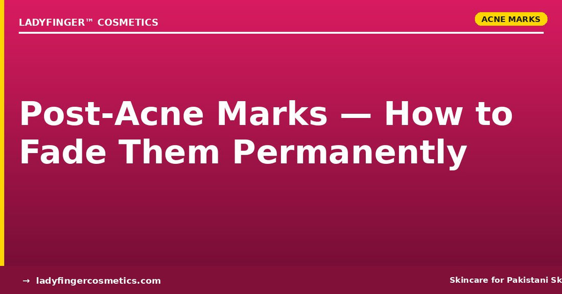 Post-Acne Marks in Pakistan — How to Fade Them Permanently