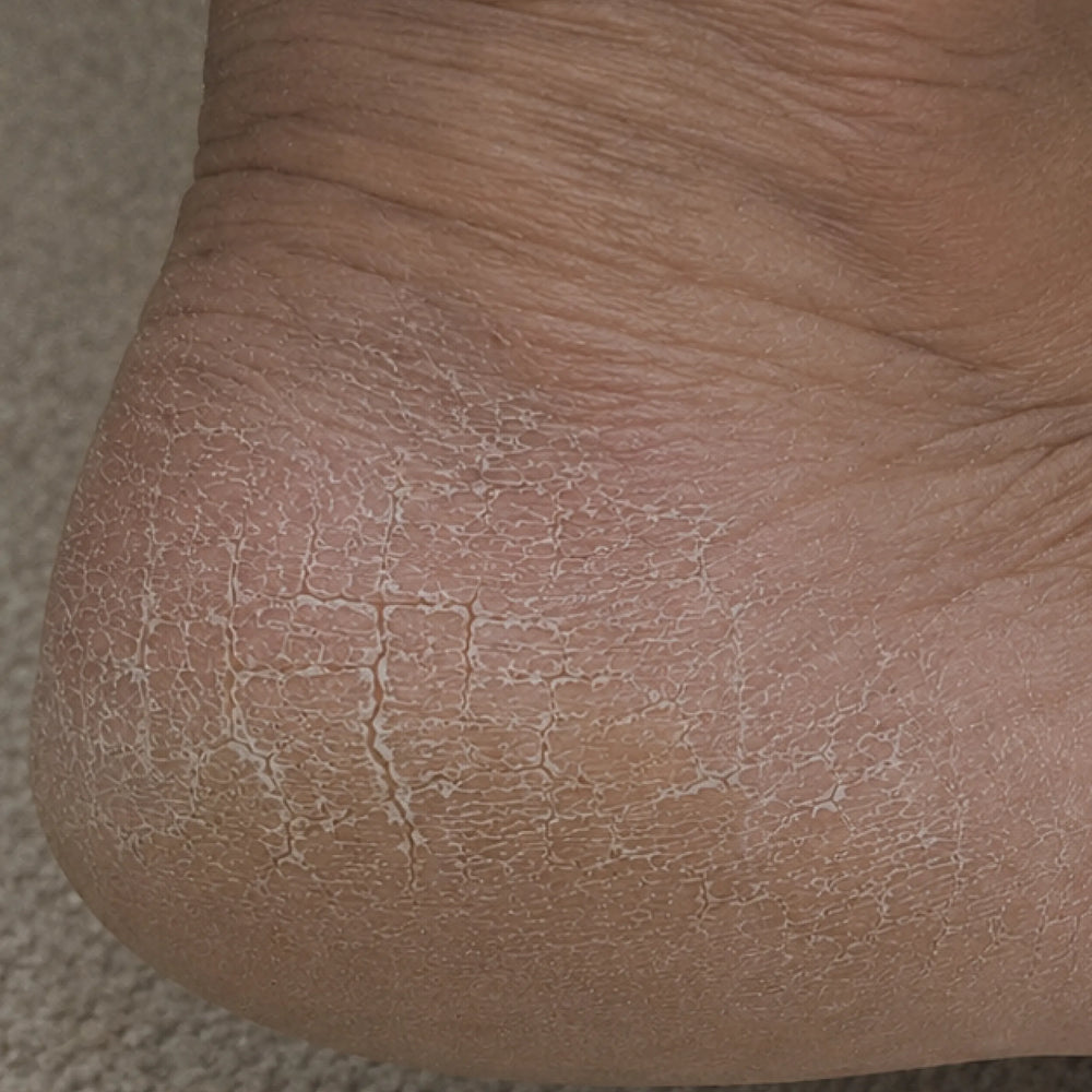 After image